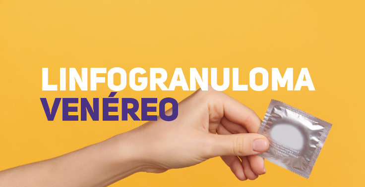 Qozogiston porno qozoq Katta mushuklar bilan yalangoch qizil sochlarning fotosuratlari